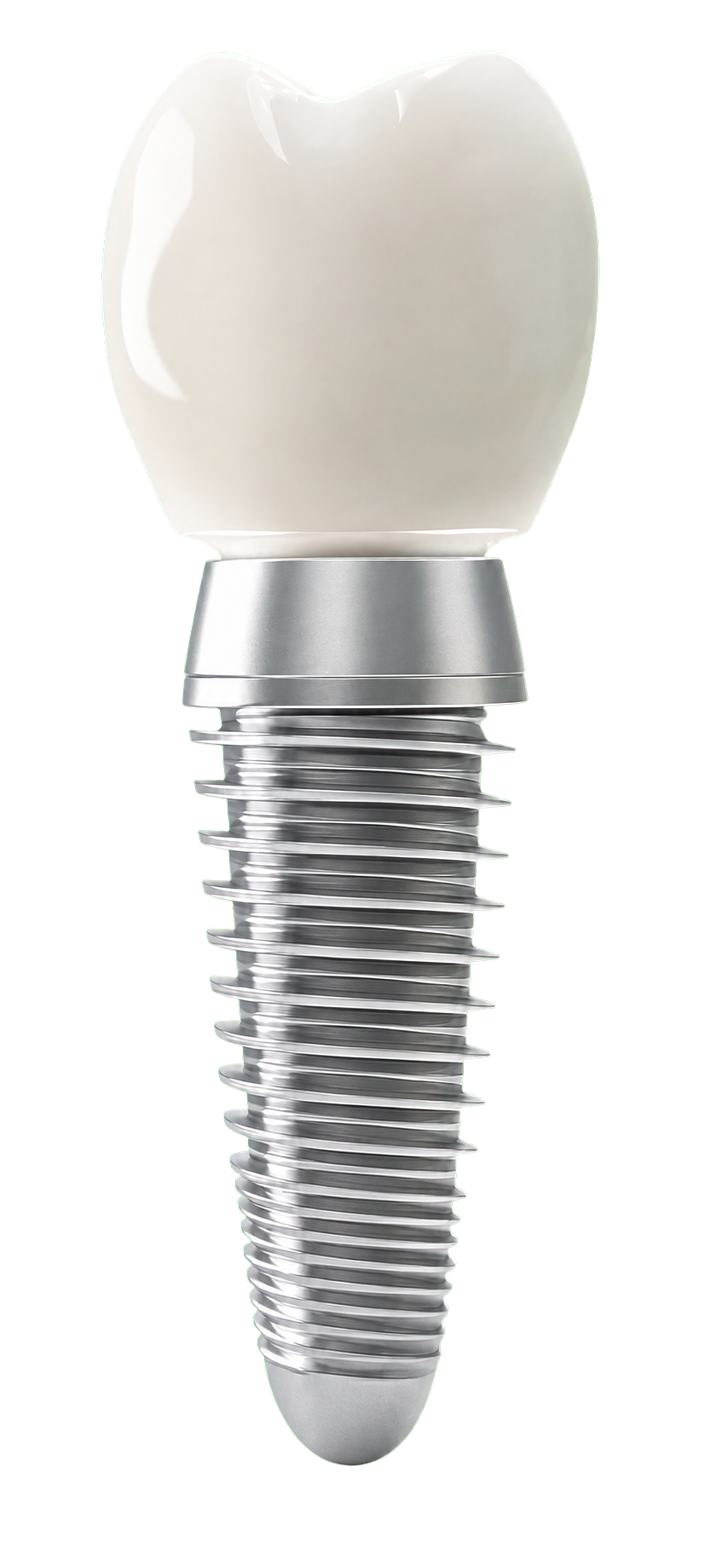 implant model