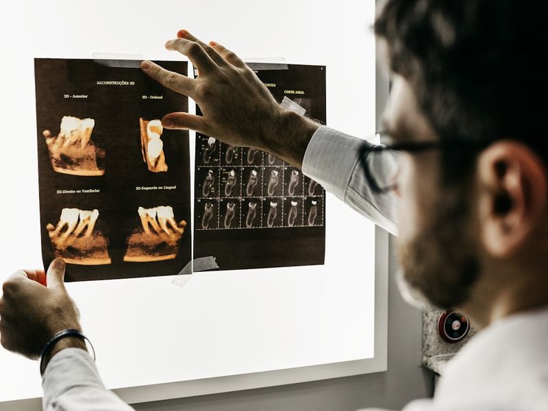 Dentist reviewing dental scans for surgery and emergency care